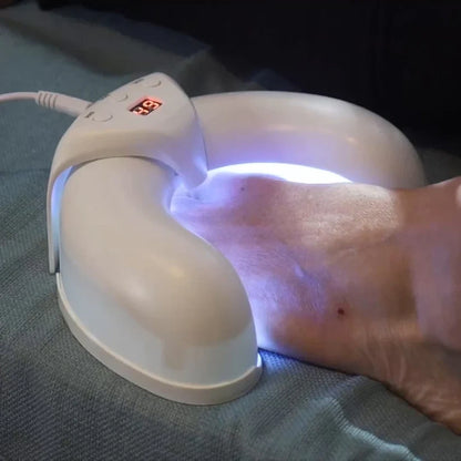 Nail Fungus Light